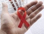 SES reforça importância da prevenção e tratamento contra HIV/Aids